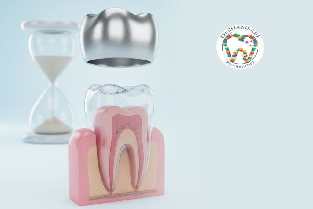 چند روز بعد از عصب‌کشی، دندان کودک باید روکش شود؟